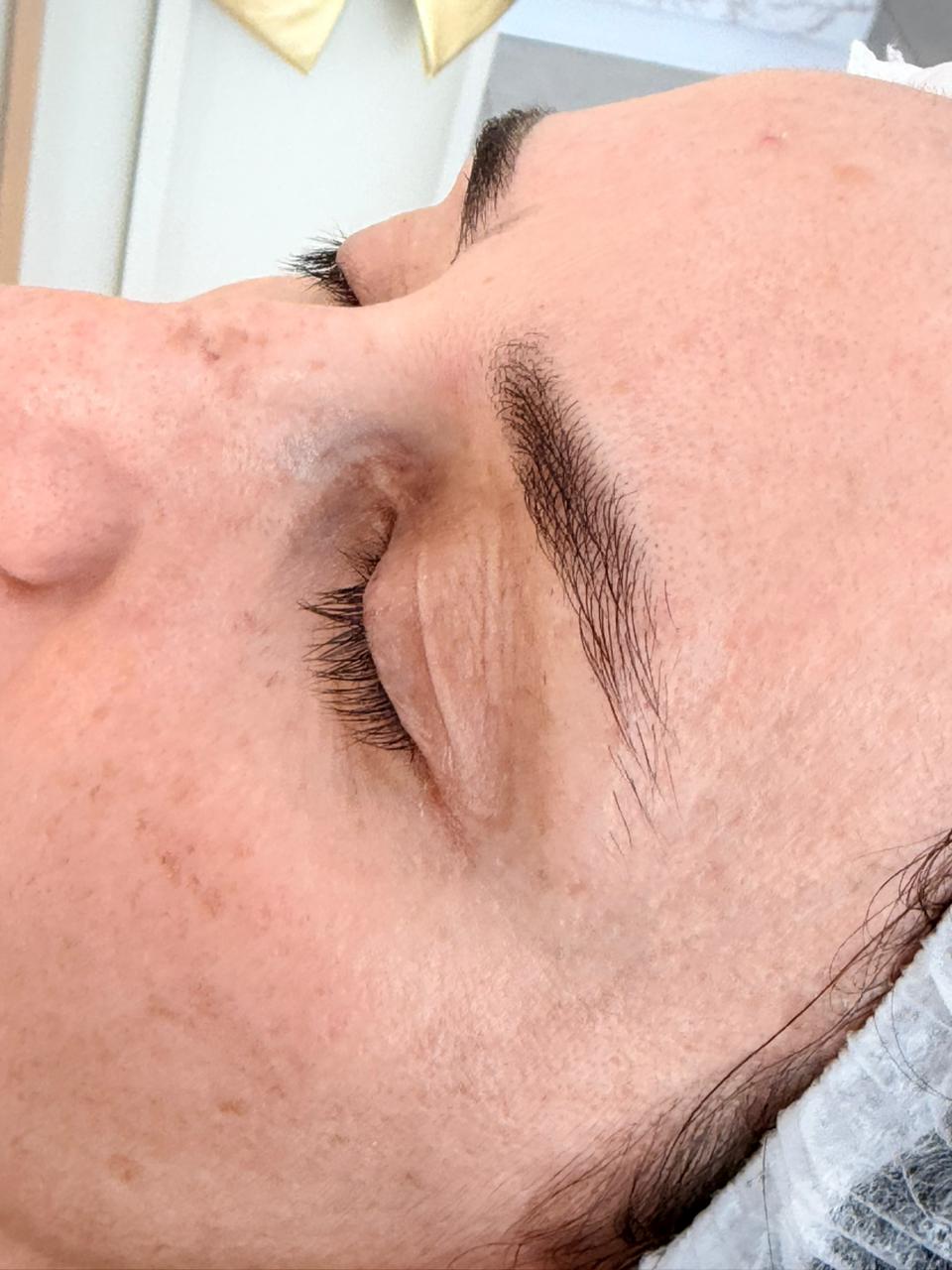 Antes do procedimento de Design de sobrancelhas