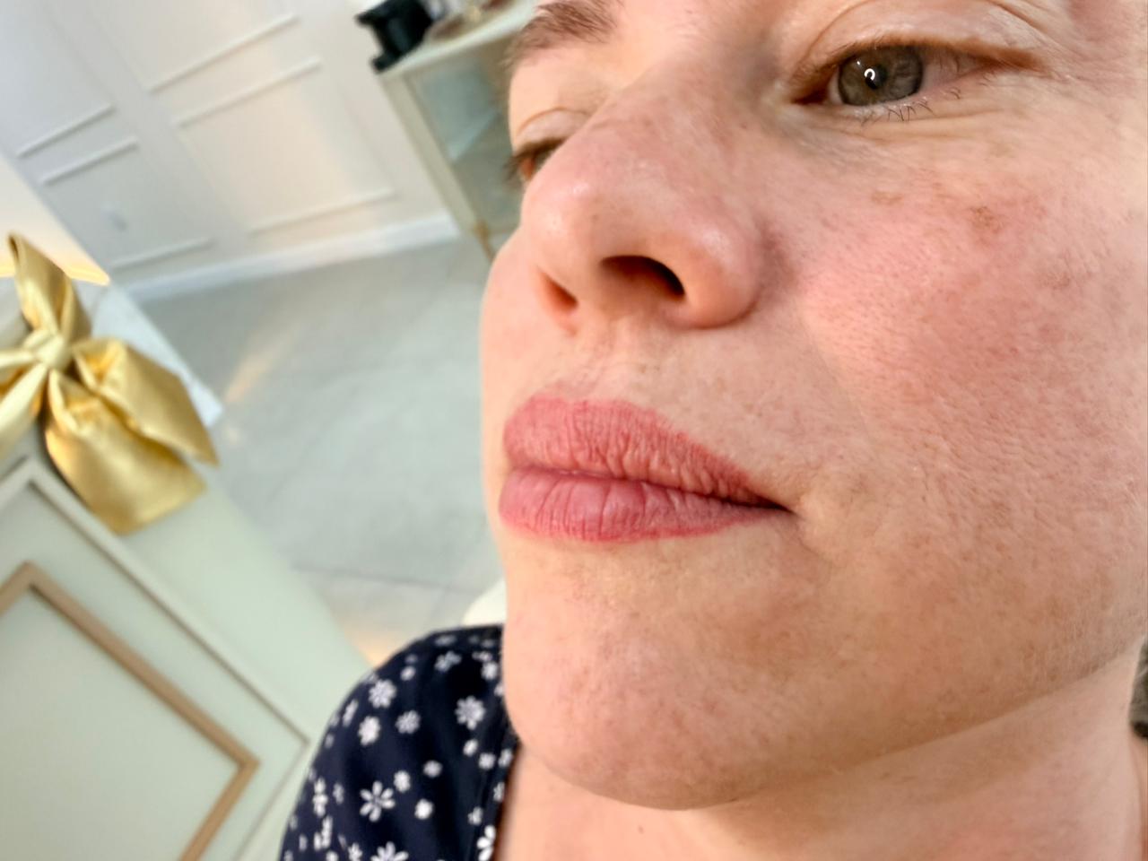 Antes do procedimento de Micropigmentação labial