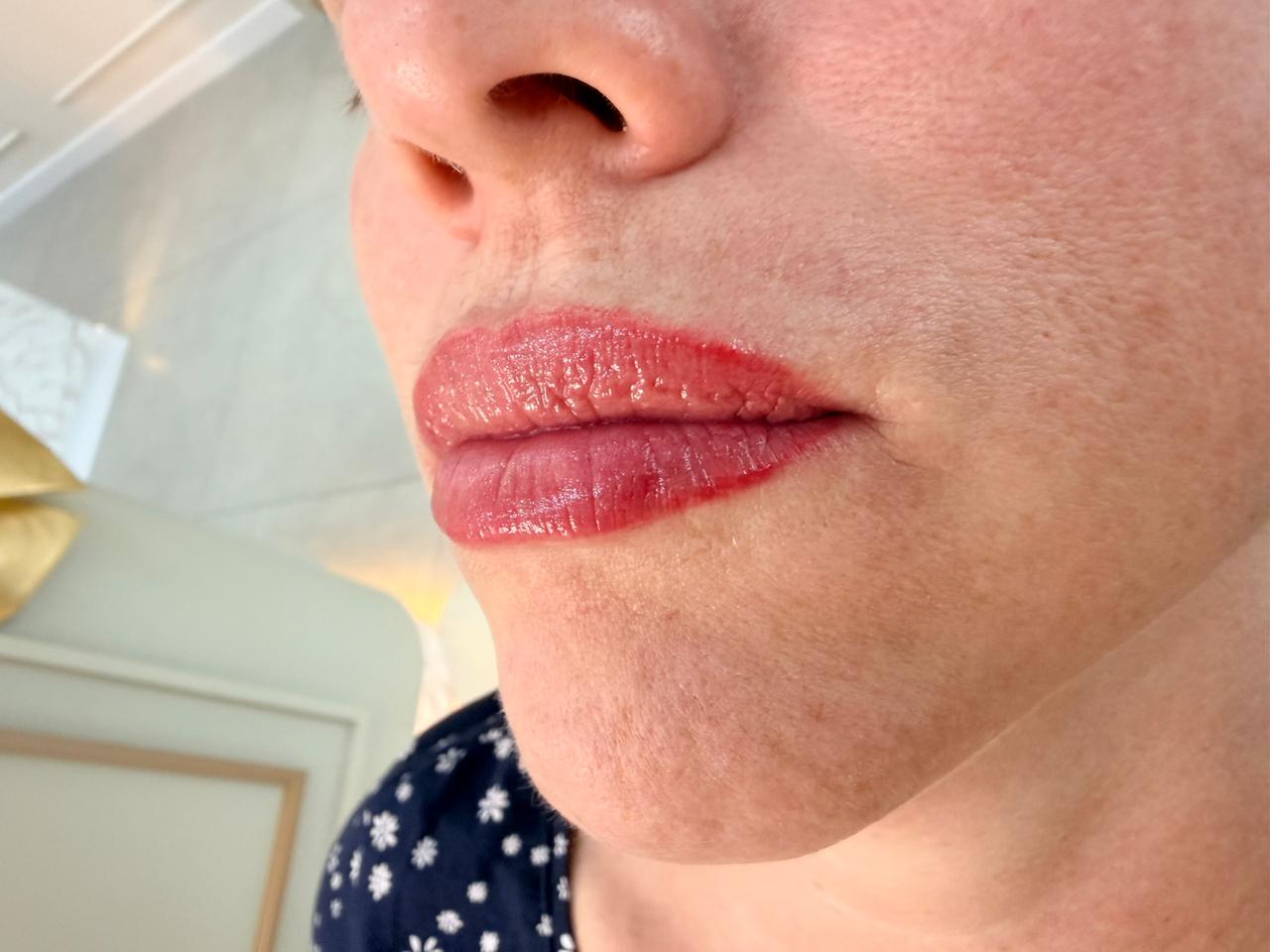 Depois do procedimento de Micropigmentação labial